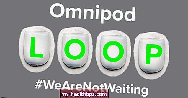 Pirmieji „pasidaryk pats“ „Omnipod Loop“ sistemos įspūdžiai