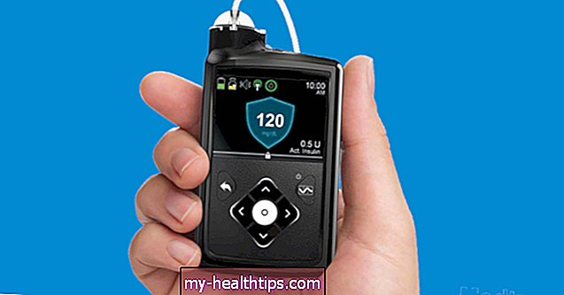 Medtronic 670G en el mundo real: los usuarios de diabetes se expresan