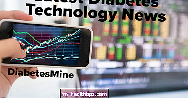 Nauja diabeto technikos peržiūra: „Omnipod DASH“, „Abbott Libre 2“, „Tandem Control-IQ“