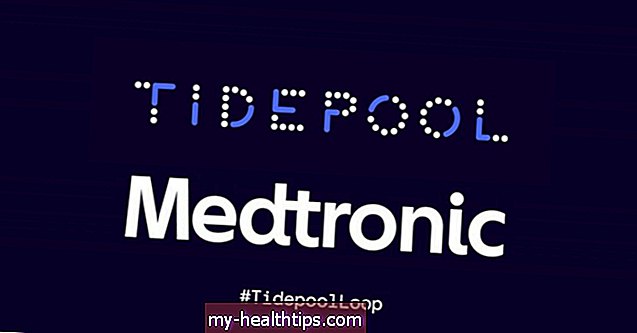 NAUJIENOS: „Medtronic“ prisijungia prie „Tidepool Loop“! Plius „Dexcom“