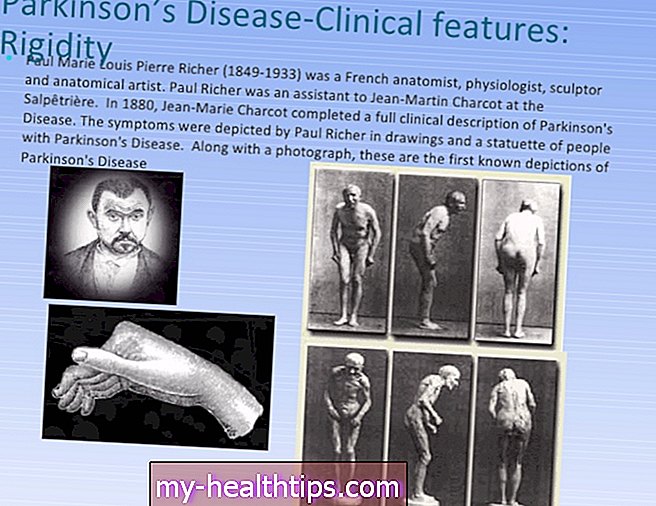 Jean (doença de Parkinson)