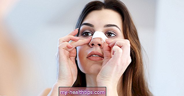 11 Ursachen für Rötungen um die Nase und was dagegen zu tun ist