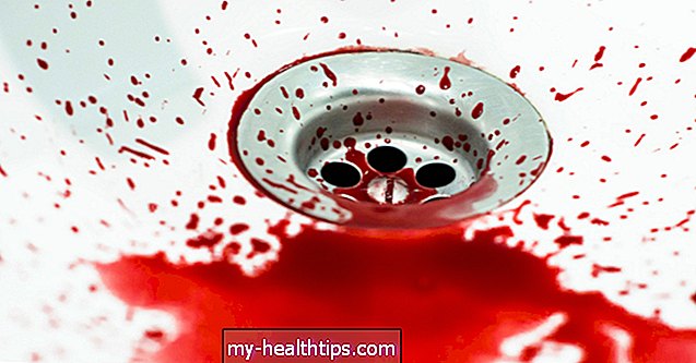 16 cosas que debe saber sobre la hematolagnia o el juego sanguíneo
