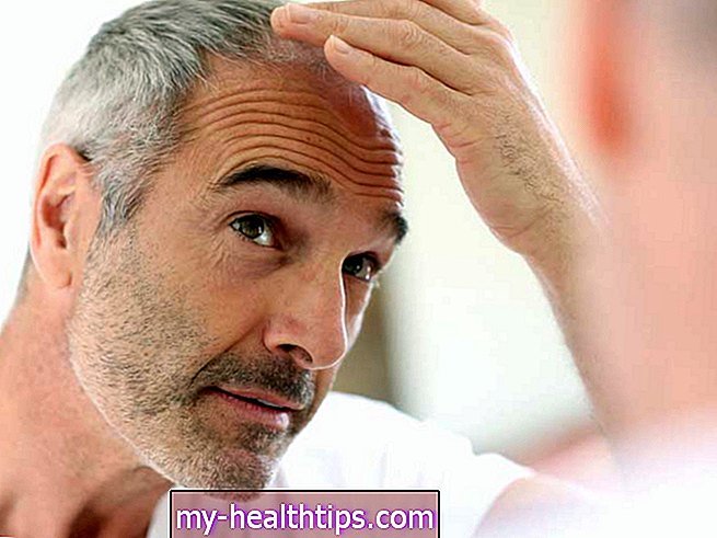 17 vyrų plaukų slinkimo procedūrų
