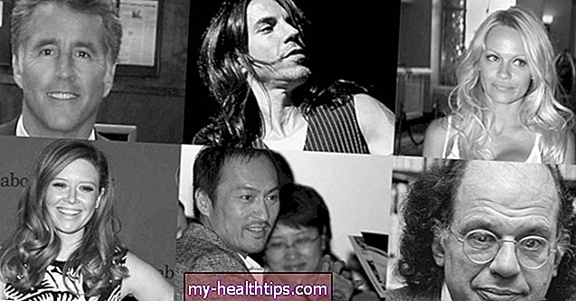 18 celebridades con hepatitis C