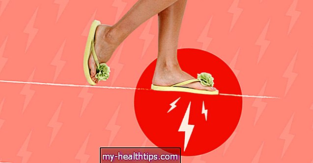 5 лекова за болове код равних стопала изазване вашим јапанкама