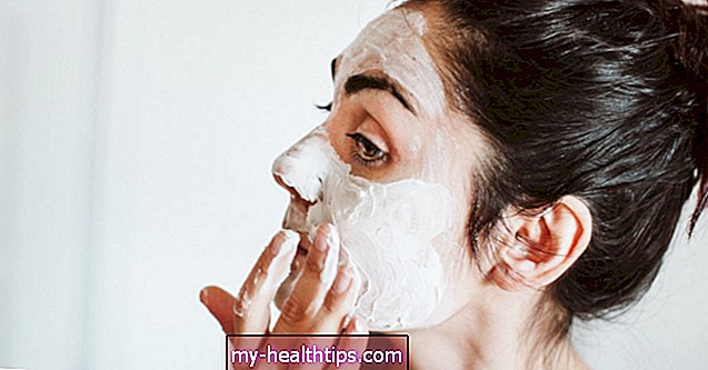 7 remedios caseros para el acné quístico