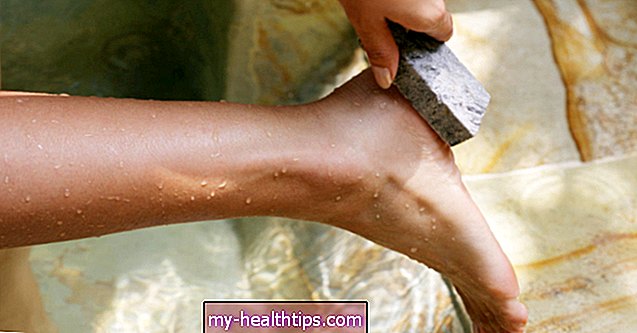 7 būdai, kaip pašalinti negyvą odą nuo kojų