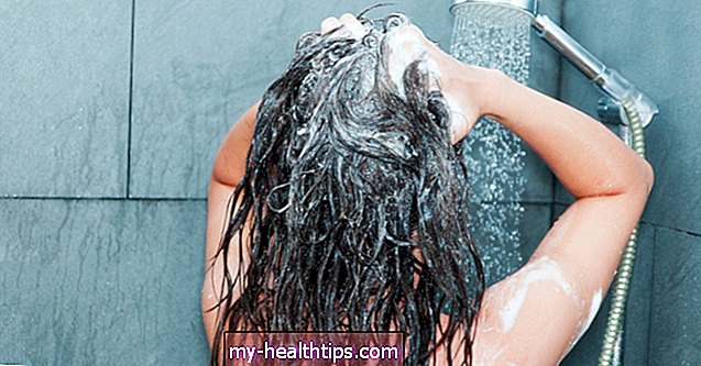 9 remedios caseros para la picazón del cuero cabelludo