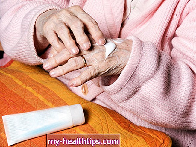 Ein Leitfaden zu den besten Schmerzlinderungscremes für Arthritis