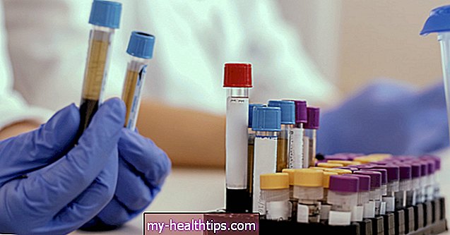 Alt om RIBA (rekombinant ImmunoBlot Assay) test