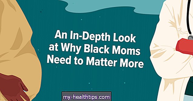 क्यों काले माताओं को अधिक की आवश्यकता है पर एक गहराई में देखो