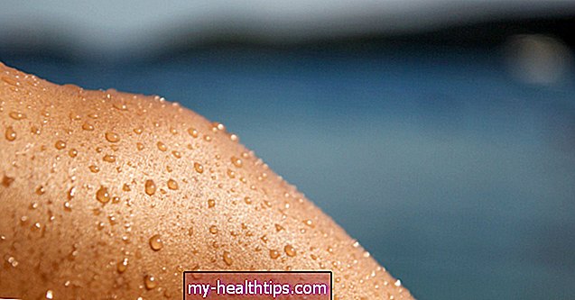 Ar saulės dėmės ant odos yra vėžinės? Skirtingų tipų odos pažeidimų palyginimas