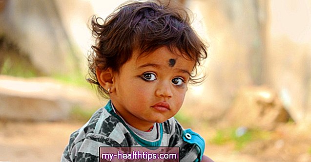 Gibt es sichere Möglichkeiten, Kajal für die Augen von Babys zu verwenden?