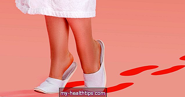Geriausi pėdų sveikatos produktai žmonėms, sergantiems diabetu