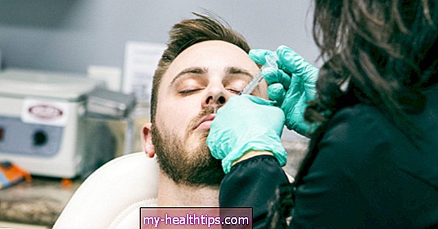 Botox vyrams: ką žinoti