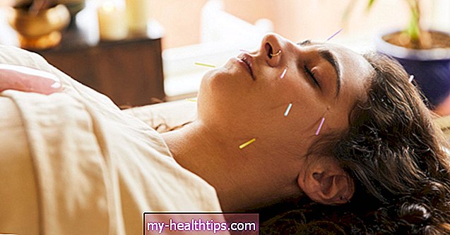 Může akupunktura zmírnit příznaky IBS?