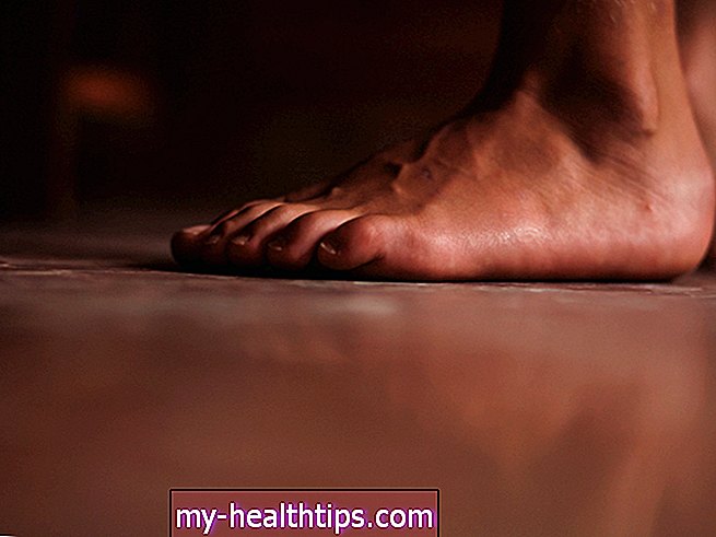 Kann Diabetes juckende Füße verursachen?