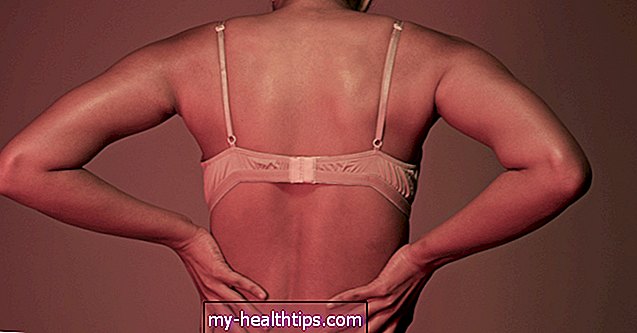 ¿Pueden los senos grandes causar dolor en la parte superior de la espalda?