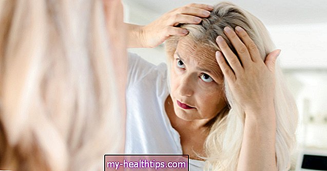 Môžu vitamíny, doplnky a ďalšie lieky zvrátiť sivé vlasy?