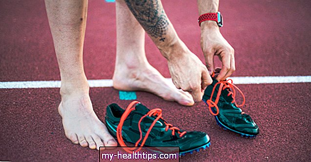 Uzroci bolova u peti nakon trčanja, plus liječenje i prevencija