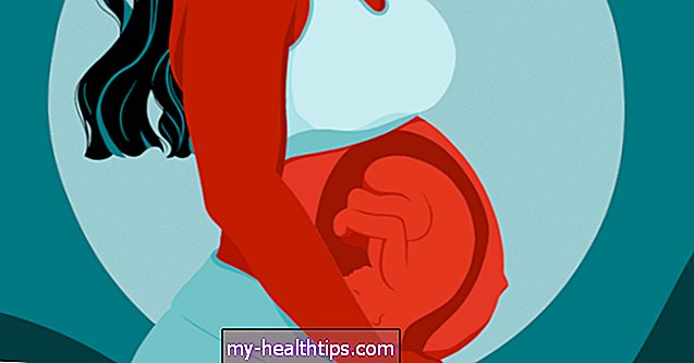 Posición cefálica: colocar al bebé en la posición correcta para el nacimiento