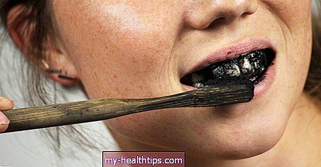 Pasta de dientes de carbón para blanquear los dientes: los pros y los contras