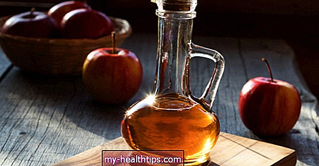Zvažujete jablečný ocet jako léčbu cyst?