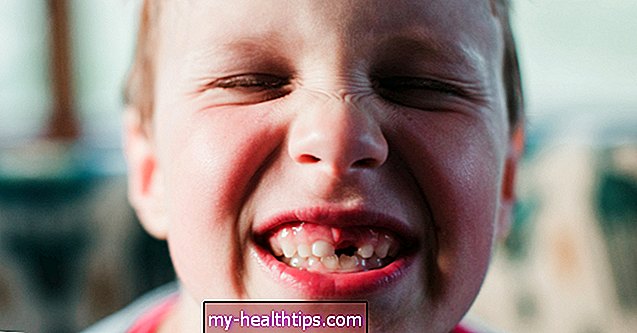 Млечни зуби