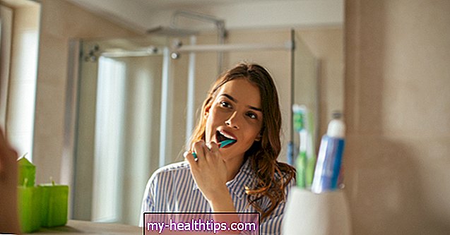 Ar veikia aktyvintos anglies dantų balinimas?