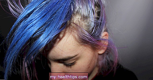 Tötet das Färben Ihrer Haare Kopfläuse?