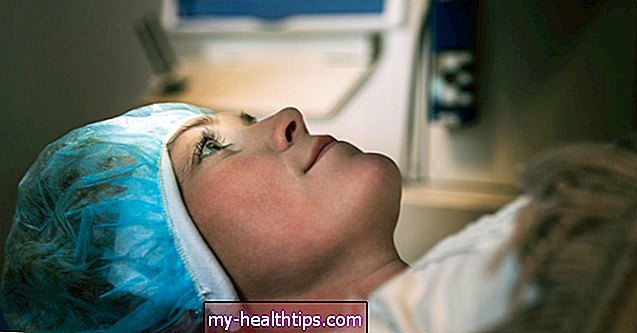 Ar skauda akių lazerinę chirurgiją (LASIK)?