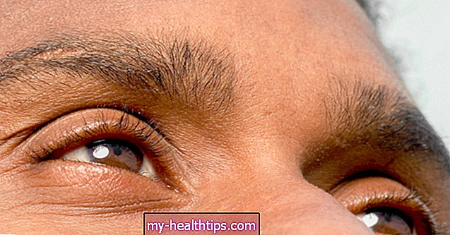 Sausos akys ar alergijos: kaip atskirti skirtumą