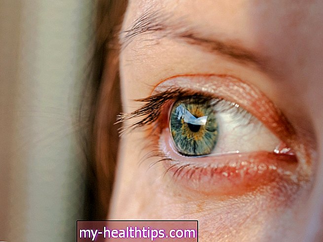 Синдром сувог ока