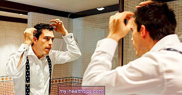 Frühe Anzeichen einer Glatze bei Männern und Frauen