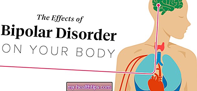 Efectos del trastorno bipolar en el cuerpo
