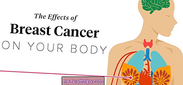 Wpływ raka piersi na organizm