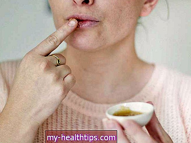 Aceites esenciales para el herpes labial