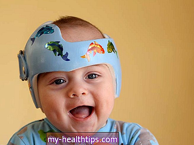 ¿Has visto alguna vez a un bebé con casco? Este es el por qué