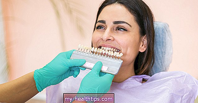 Всичко, което трябва да знаете за получаване на зъбна коронка