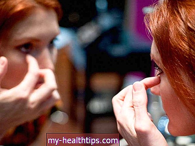 Alles, was Sie über Augenherpes wissen sollten