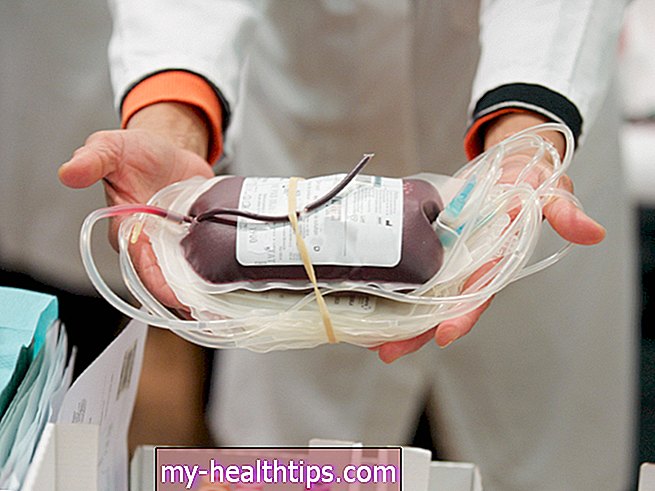 تبادل نقل الدم