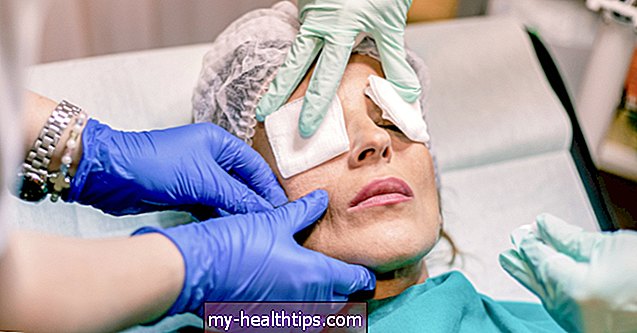 Хирургија очних врећица: шта треба да знате ако размишљате о овој естетској хирургији