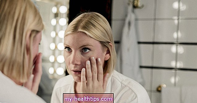 Hefeinfektionen im Gesicht: Ursachen und Behandlung