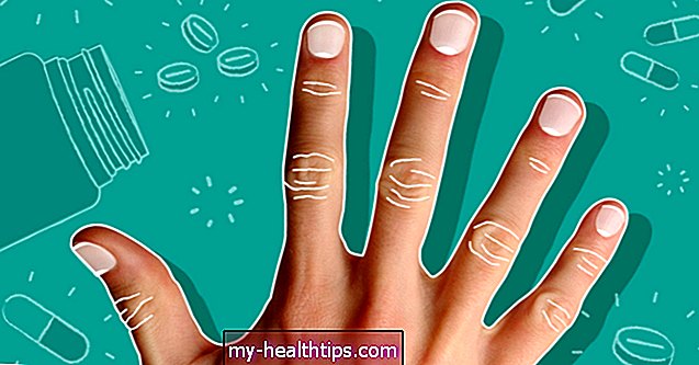 De las crestas a la descamación: lo que estos 8 signos de uñas dicen sobre su salud