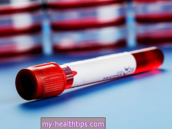 Krvný test FTA-ABS