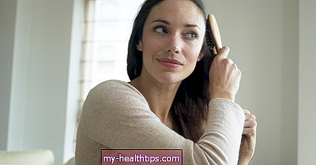 Moterų plaukų slinkimas