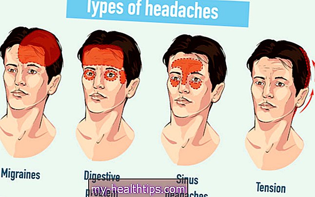 Galvos skausmas nuo miego trūkumo? Štai ką daryti