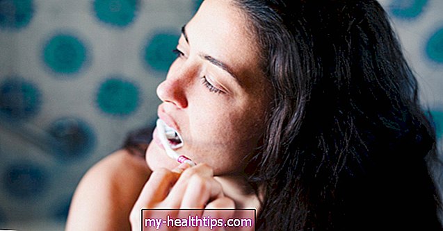 Tu je to, čo sa stane, keď si nečistíte zuby