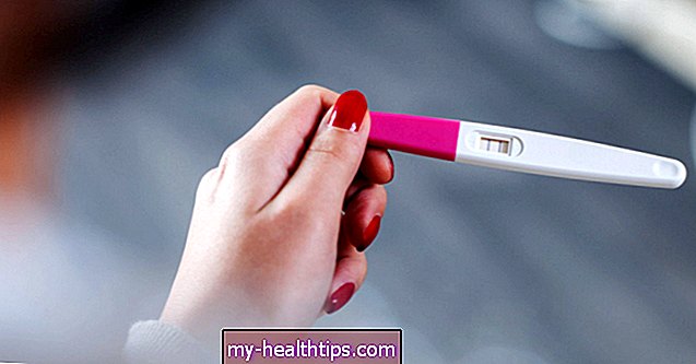 Inilah Yang Harus Anda Ketahui Mengenai Kehamilan dengan IUD